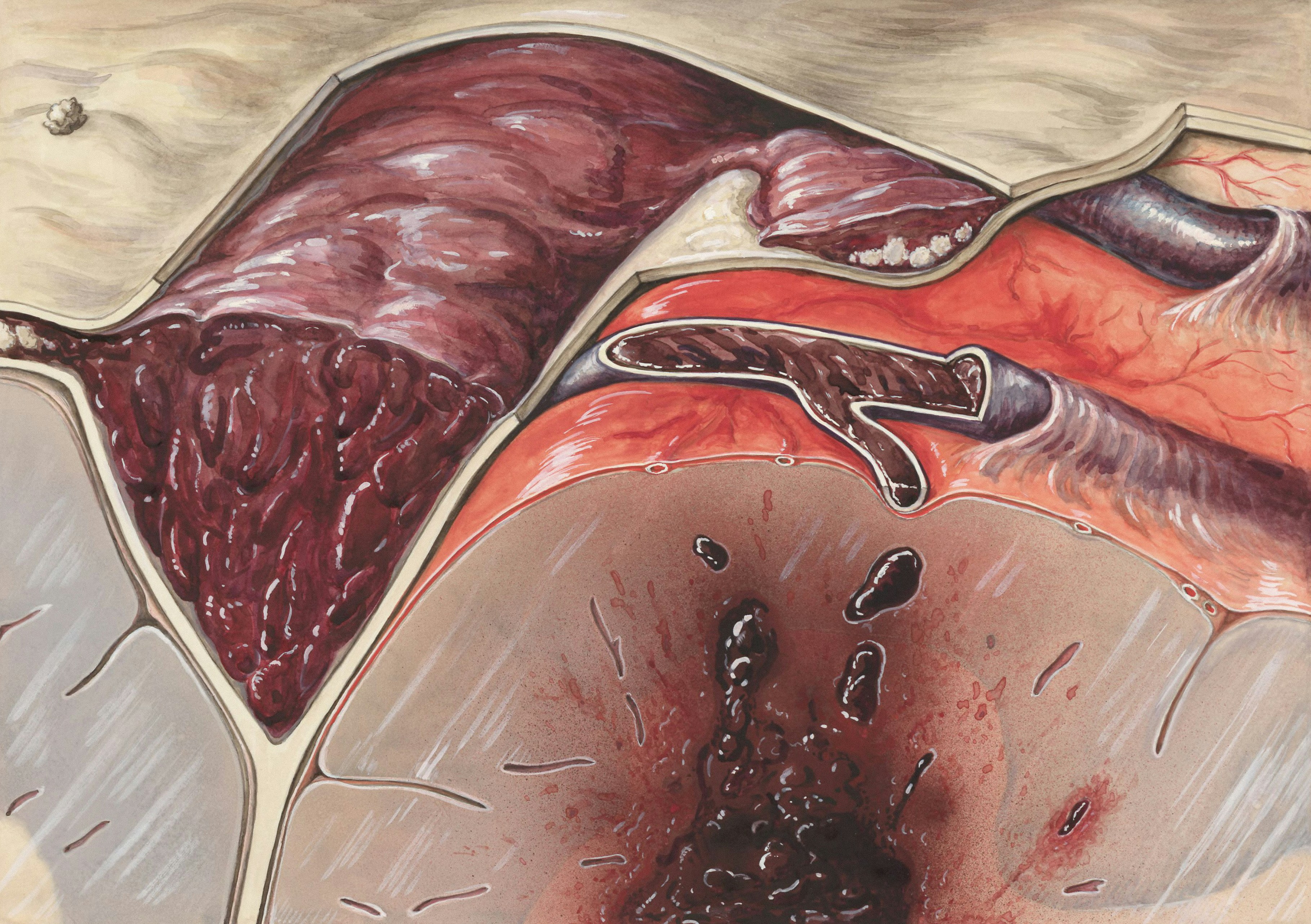 A severe brain hemorrhage with blood clots — por Europeana no Unsplash
